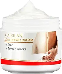 Creme para estrias para mulheres | Adequado para gravidez e pós-parto | Creme anti-estrias | Reparação poderosa para estrias, tratamento para estrias, creme reparador para estrias