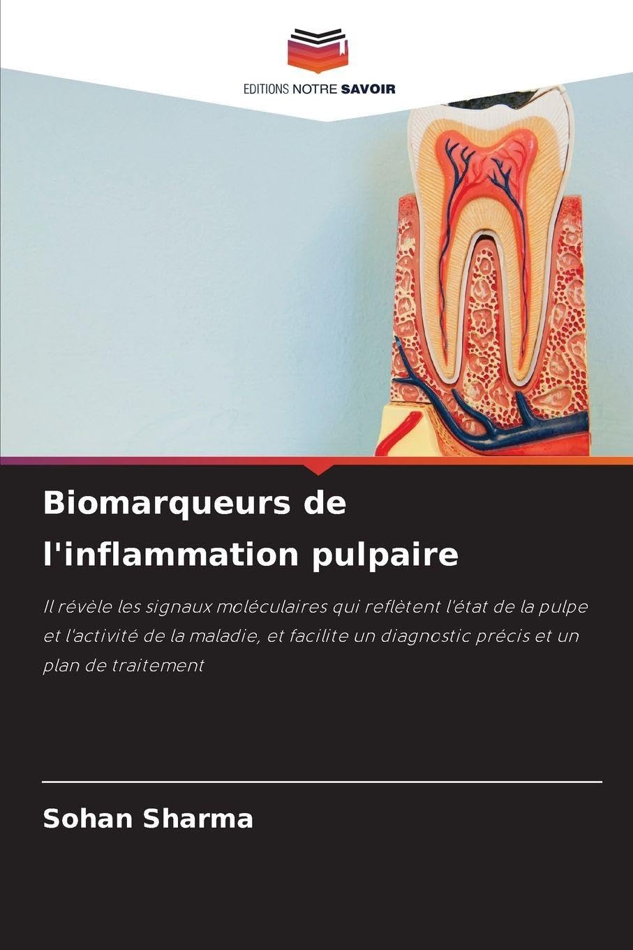 Biomarqueurs de l'inflammation pulpaire: Il révèle les signaux moléculaires qui reflètent l'état de la pulpe et l'activité de la maladie, et facilite un diagnostic précis et un plan de traitement
