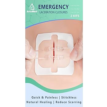Amazon.com: Emergency Wound Closure Device, Zip Sutures
