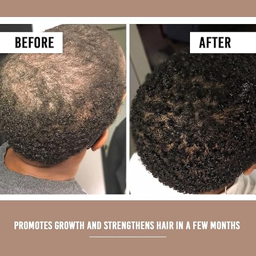 Miniatura 7 de Amyla Cosmetics Suero para el crecimiento del cabello, tratamiento capilar para mujeres 1 onza líquida (1.0 fl oz)