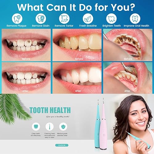 Kit de limpieza dental ultrasónica con eliminación avanzada de placa para el cuidado bucal en el hogar - imagen 2