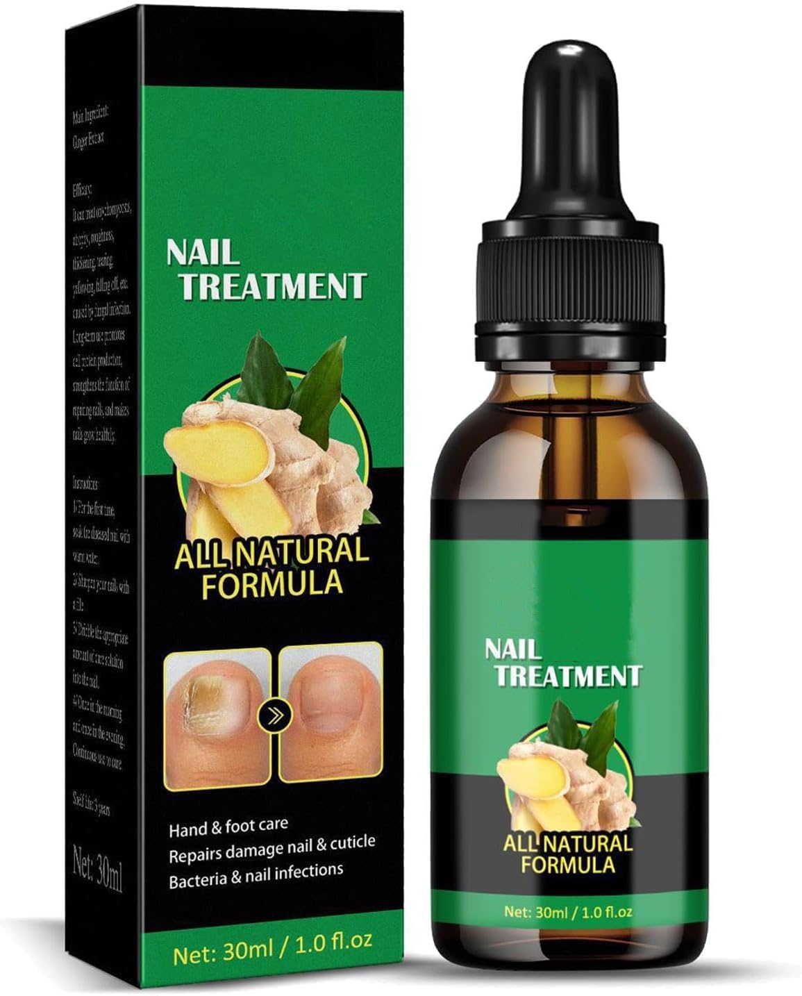 GingerNail Treatment Nail Support Nail Care, Nail Treatment,GingerNail GrowthSerum, Ginger NailTreatment, Ginger Cuticle Care Oil for DamagedNails (1pcs, 30ml)