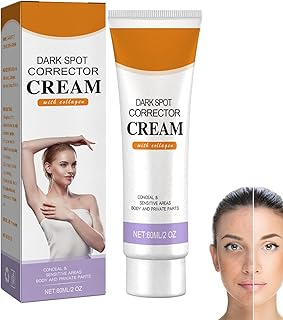 Dark Spot Remover for Face, Underarm Cream, Dark Spot Correcting Glow Serum, Age Spot Remover for Face for Dark Skin & Private Parts, Fade Melanin on Body Armpit Knees, Elbows, Even Skin Tone