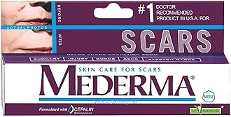 Skin Care (Helps Scars -Surgery, Injury, Burns, Acne,Stretch marks)