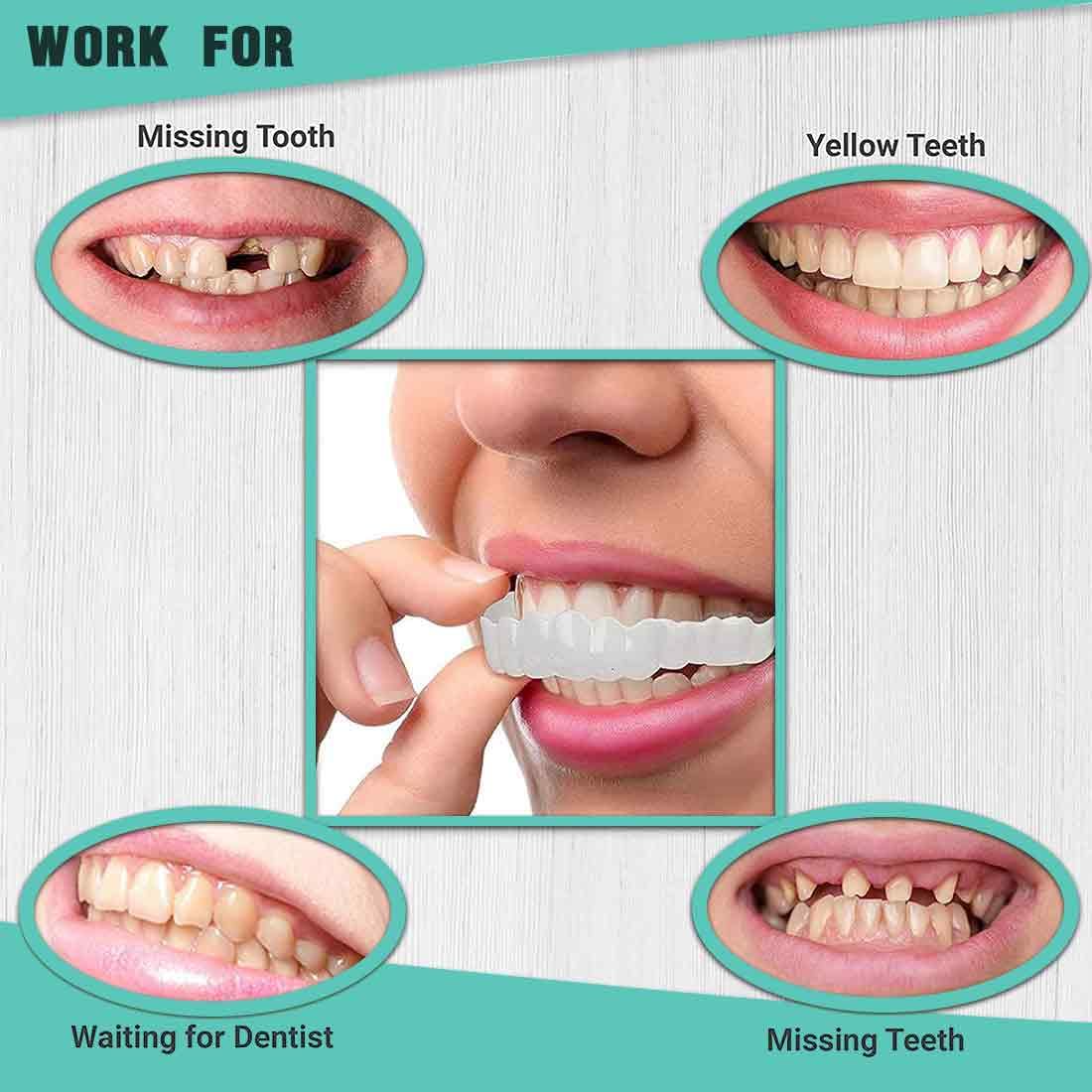 2 Paia Faccette Istantanee, Protesi a Sorriso Perfetti, Denti Finti Cosmetici, impiallacciature denti copertura dentale cosmetica, Denti Finti Cosmetici per Donne e Uomini