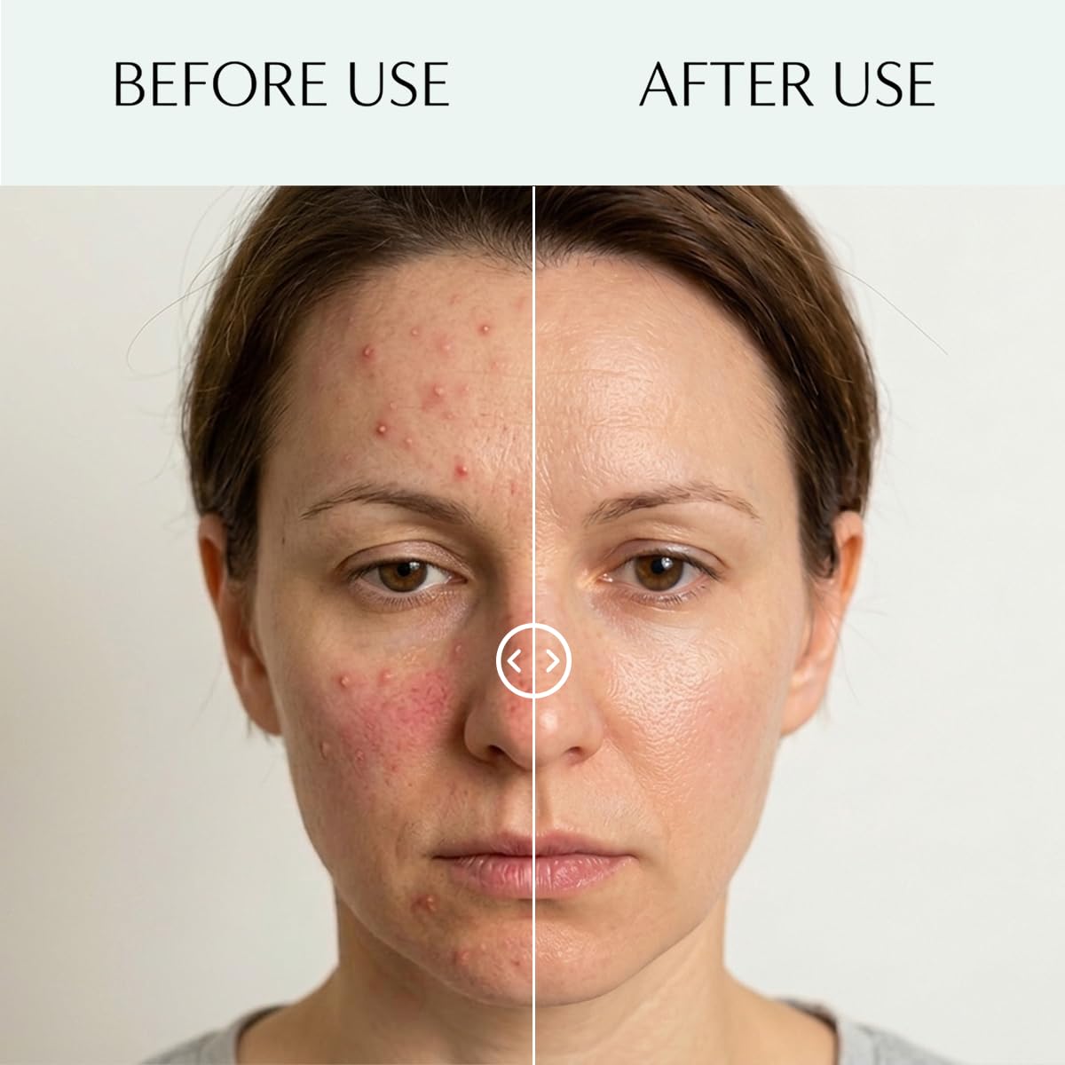Complesso Acido Esfoliante per il Viso – Esfoliazione Delicata Schiarente e Antinfiammatoria – Riduce Macchie e Acne – Adatto alle Pelli Sensibili – Esfoliazione Avanzata per una Pelle Radiosa (35%)