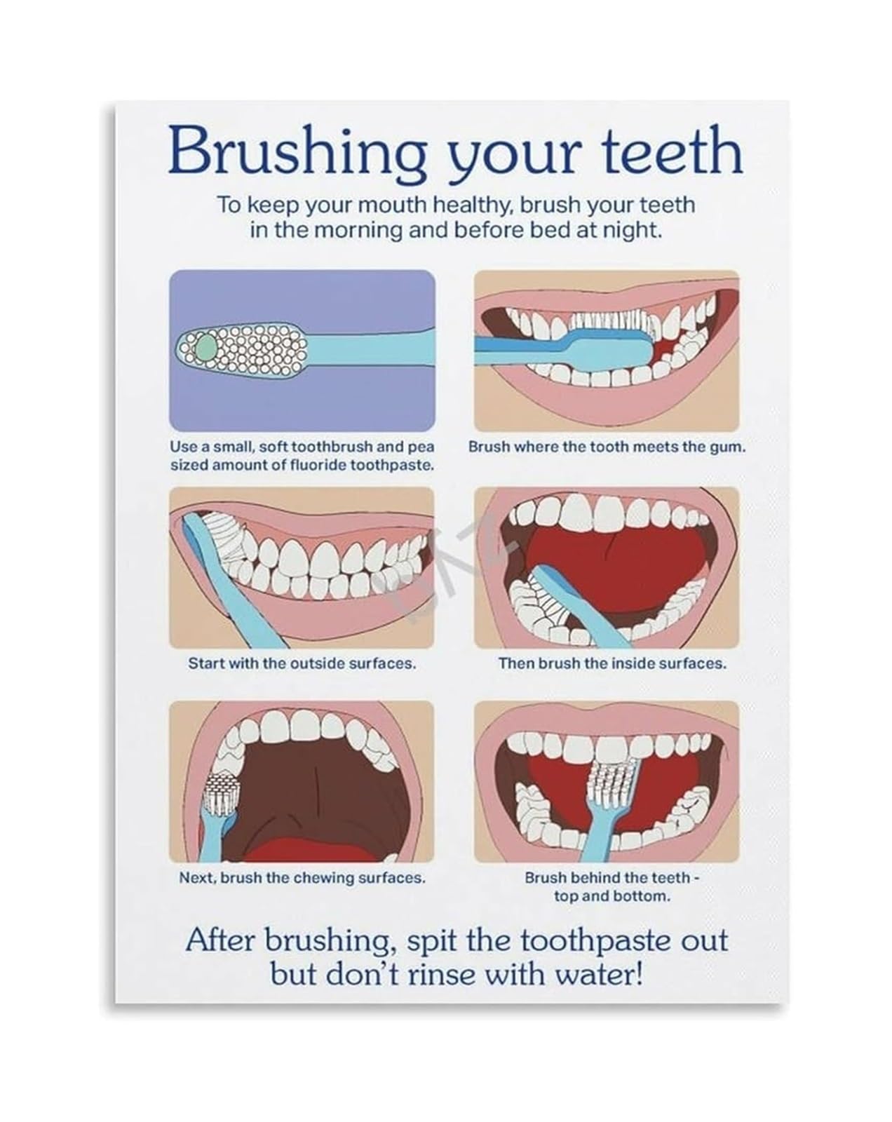 IDGTTLDF Hygiene Education Poster Complete Guide to Brushing Flossing and Mouth Care Visual Aid for Patient Education in Office Framed,08x12inch(20x30cm)