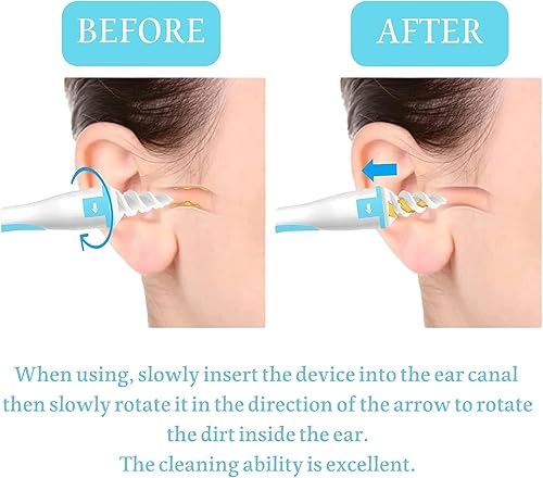 Miniatura 2 de Q-Grips - Removedor de cera de oído, herramienta de limpieza de oídos de silicona suave, herramienta de eliminación de cera de oído con 16 cabezales