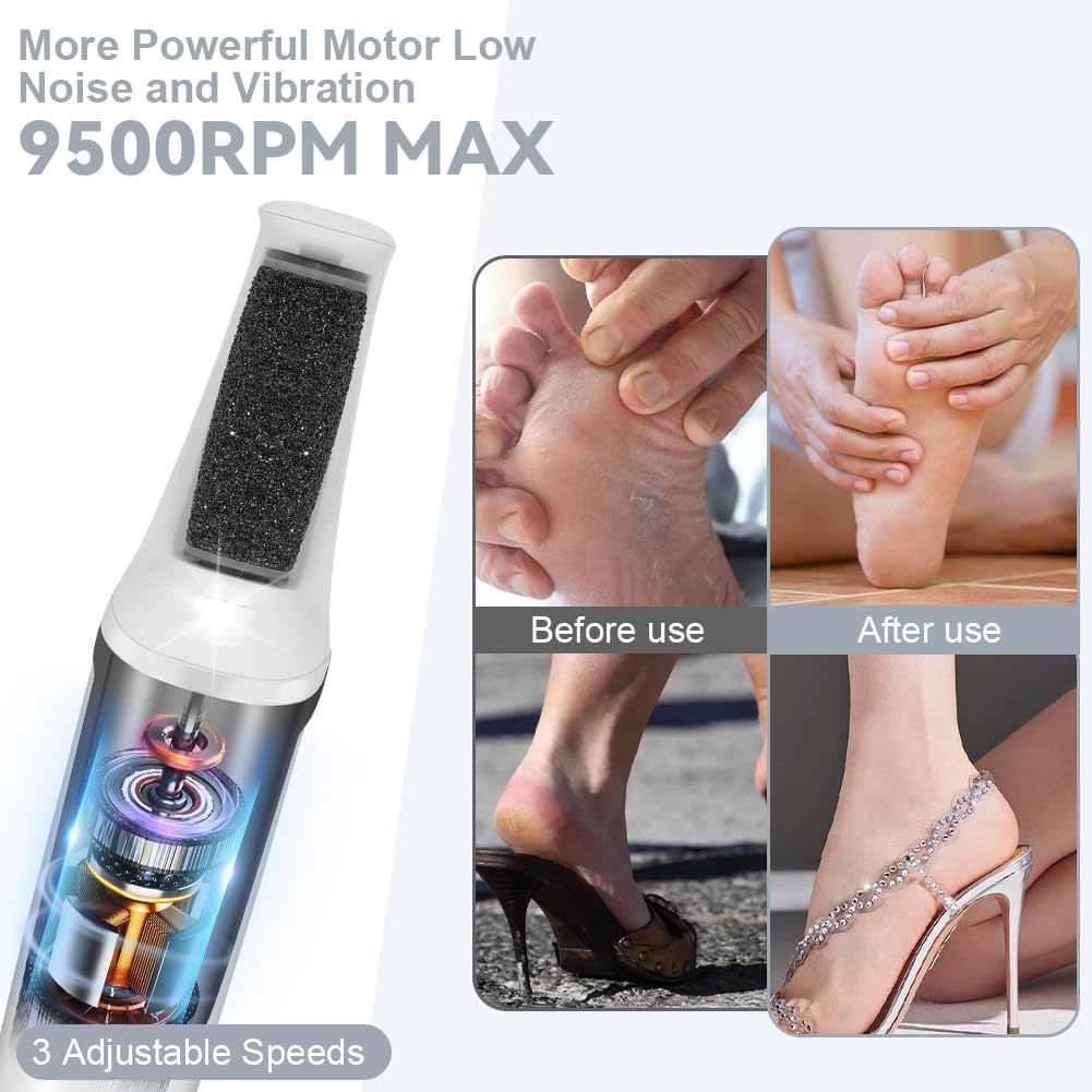 AOOWU Removedor Eléctrico de Callos de Pies, 3 Velocidades Ajustables Profesional Quita Durezas Electrico, Herramientas de Pedicura Recargables con 3 Cabezales de Rodillo Extraíbles para Piel Muerta
