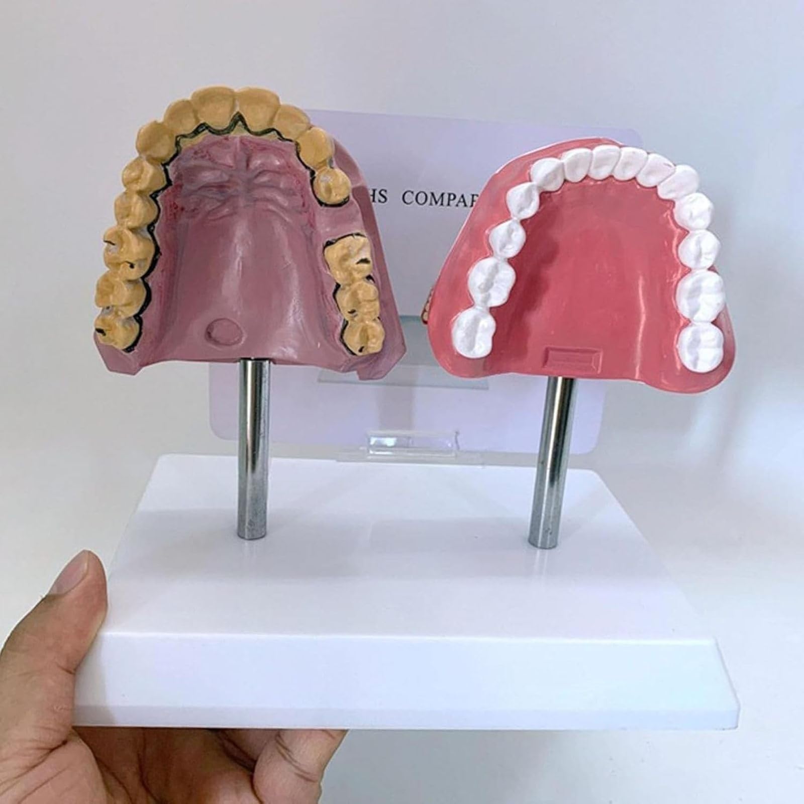 Modello Anatomico dei Denti del Orale Umano, Struttura Anatomica Accurata E Patologica, per Studenti di Odontoiatria