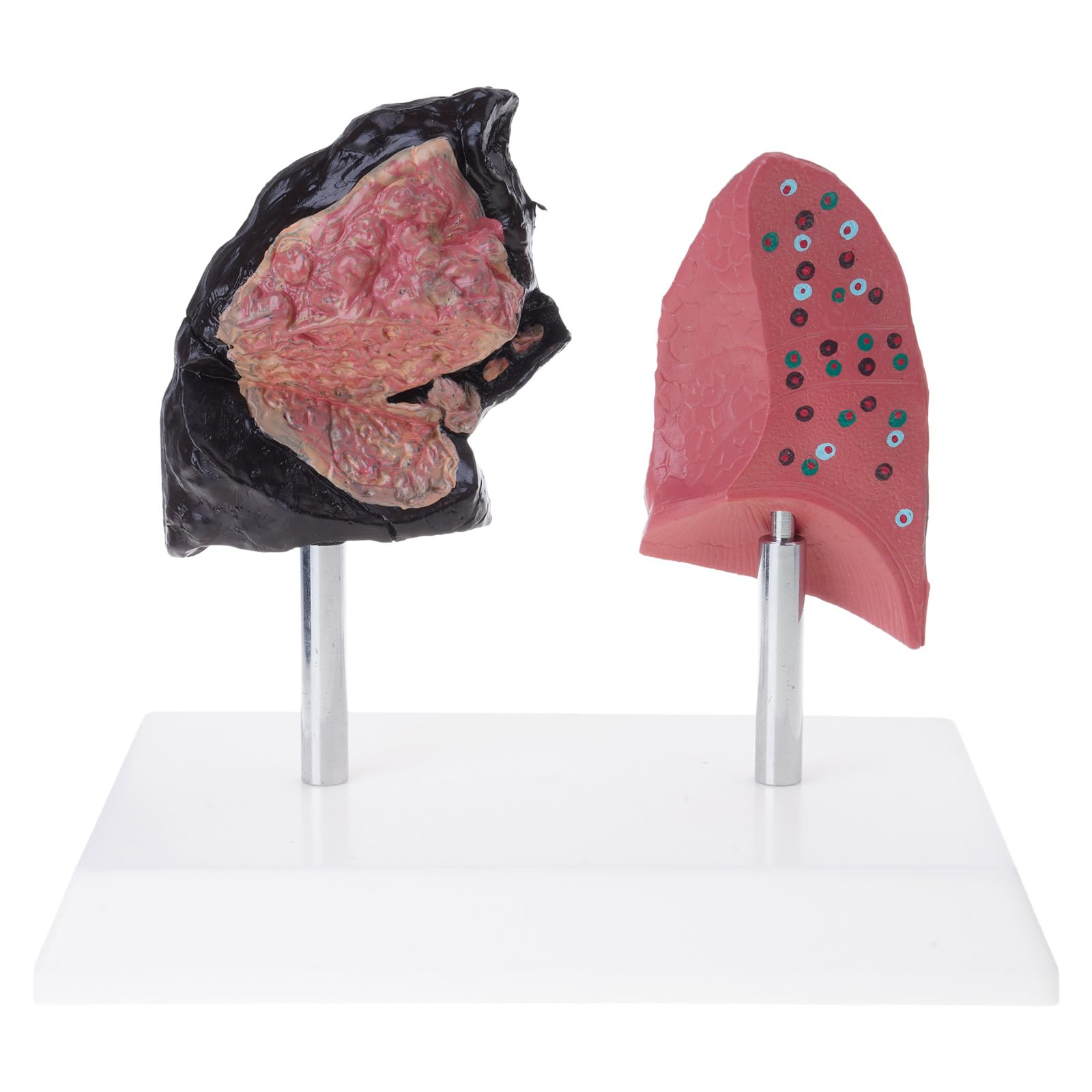 Rbrmhm As The Pic Show Puffing Lung Vs Lung Comparative Model For Clinical Education Permanent Pvc Structure Teaching Tool