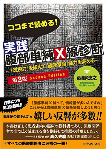キンドル 無料電子書籍 ココまで読める!実践腹部単純X線診断―「透視力」を鍛えて「臨床推論」 バイ