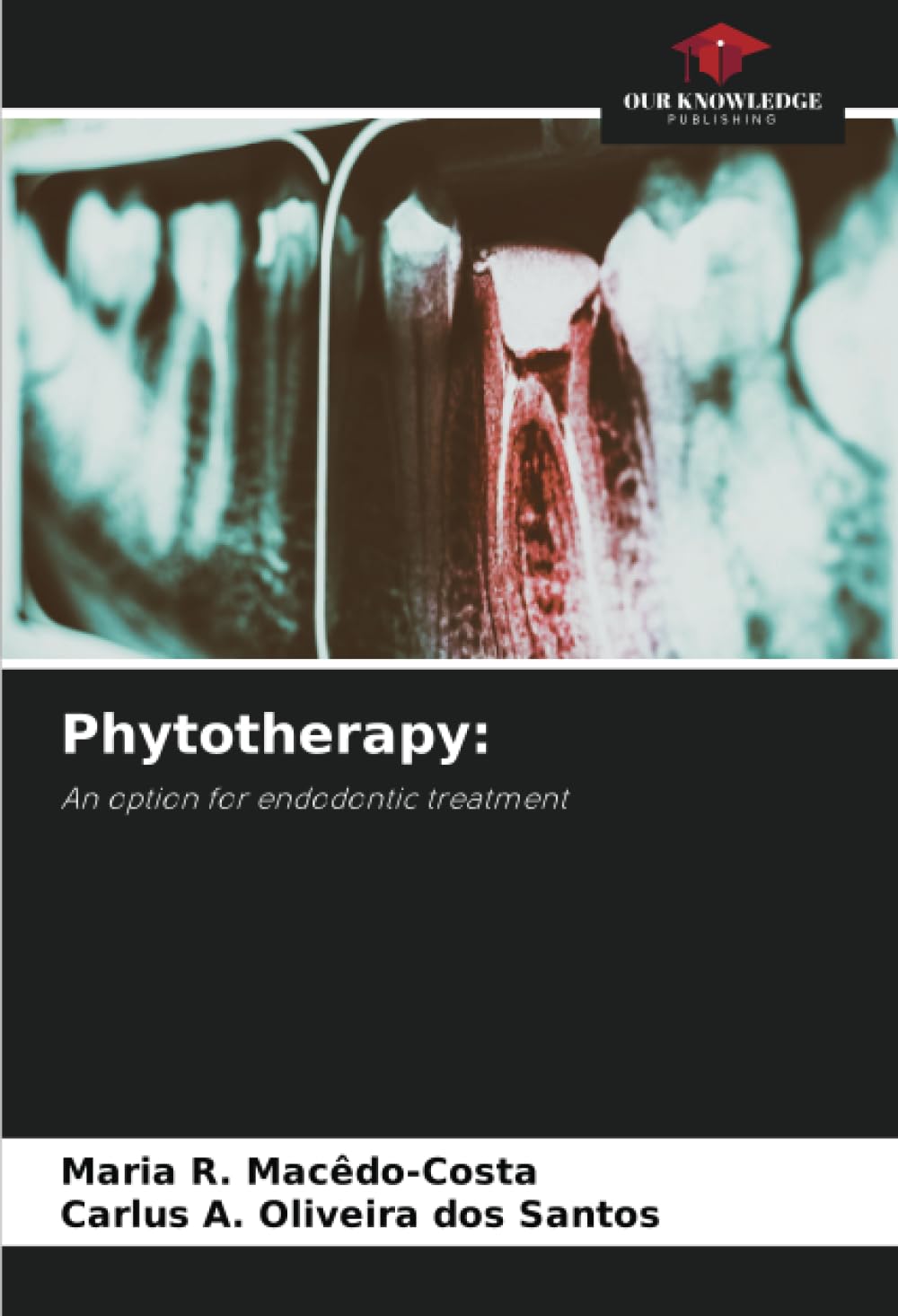 Phytotherapy:: An option for endodontic treatment