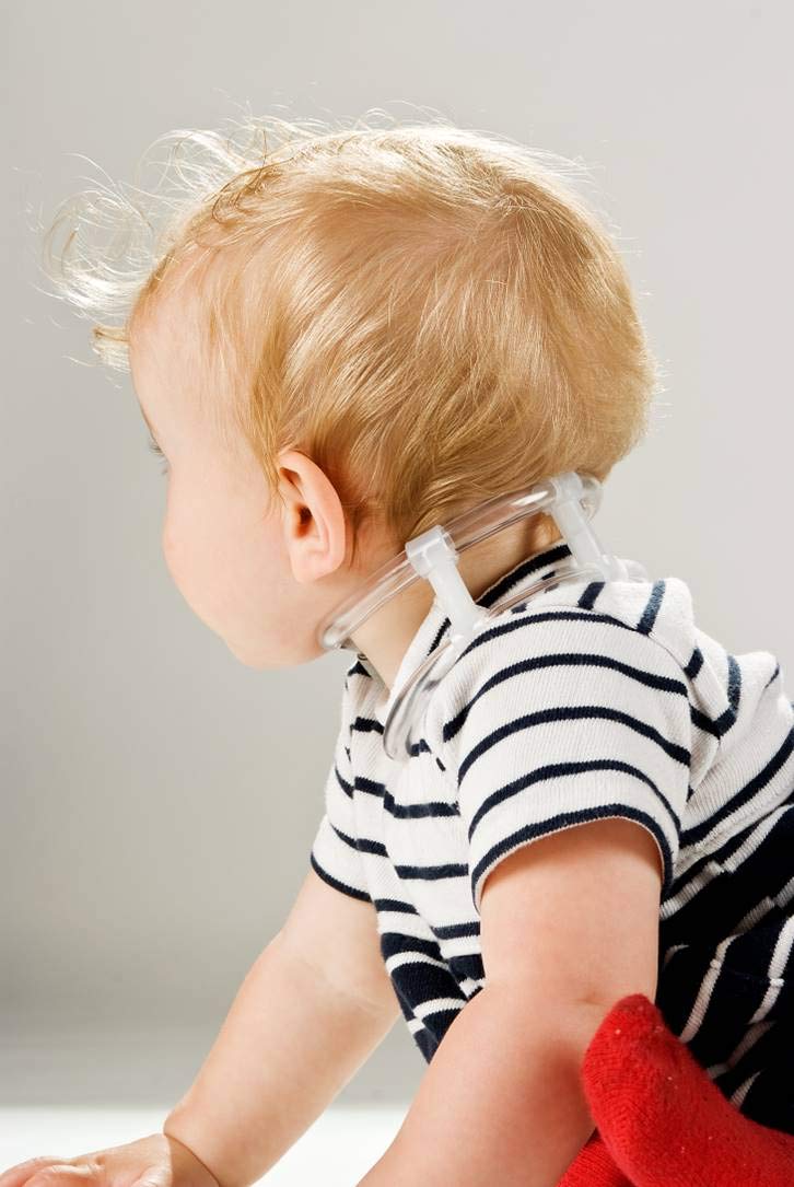 El cuello TOT - para el manejo eficaz de la tortícollis muscular congénita (adulto)