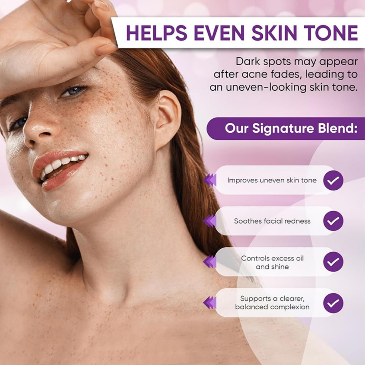 14% Azelaic Acid Cream for Face | Gentle Skin Care with Niacinamide, Tranexamic Acid, Hyaluronic Acid & Salicylic Acid | Hydrating & Soothing Facial Moisturizer for All Skin Types | 30g / 1oz - 3