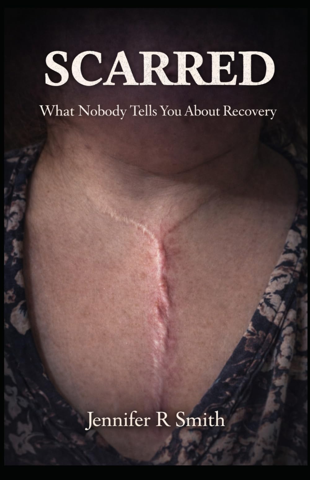 Scarred: "What nobody tells you about recovery"