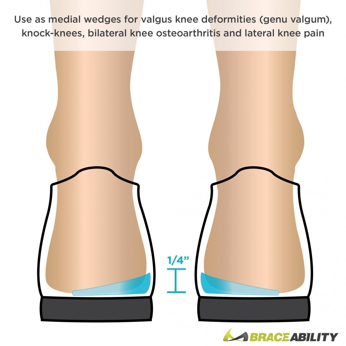 Medial Lateral Heel Wedge Inserts Varus Valgus Insoles For Shoes