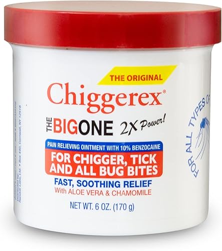 Chiggerex 2X Power - Pomada medicada para primeros auxilios para niguas, picaduras de mosquitos, garrapatas y picaduras de insectos con aloe vera y