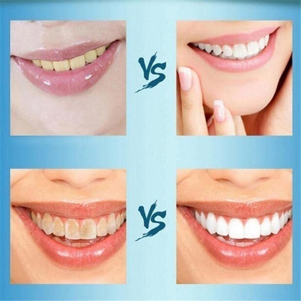 ATORSE 2 Pcs 10Ml Teeth Whitening Water Oral Hygiene Care Tooth Cleaning Liquid|Health & Beauty|Health Care|Other Health Care Supplies 2
