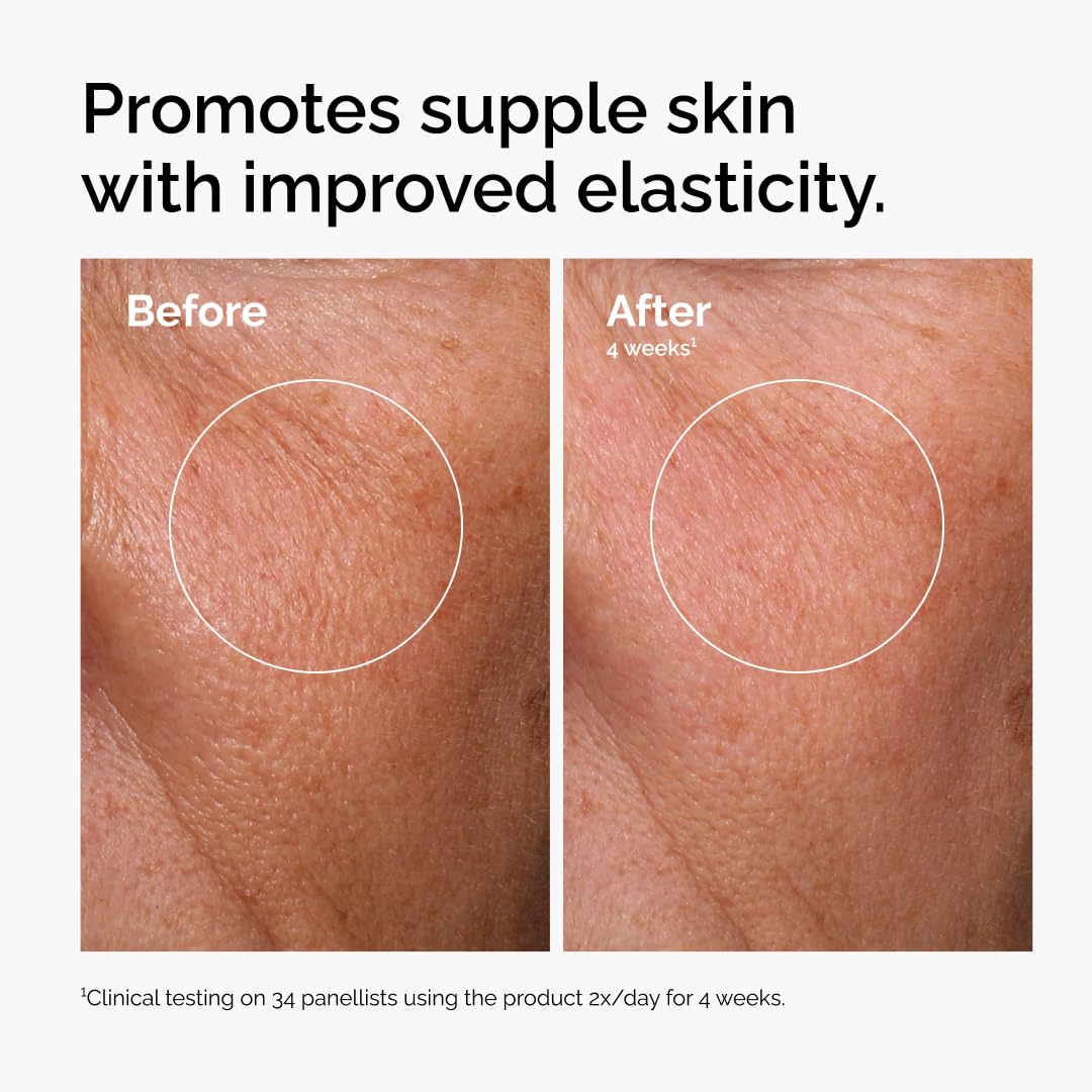 The Ordinary Hyaluronic Acid 2% + B5 (with Ceramides), Multi-Depth Hydration Serum for Plumper, Smoother Skin — Amazon image 3
