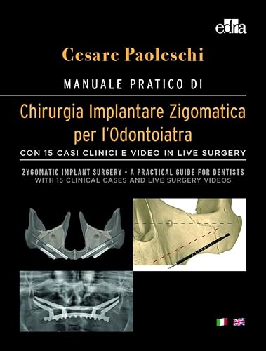 Manuale pratico di chirurgia implantare zigomatica per l’odontoiatra. Con 15 casi clinici e video in live surgery-Zygomatic implant surgery. A ... surgery videos. Ediz. a colori. Con DVD video