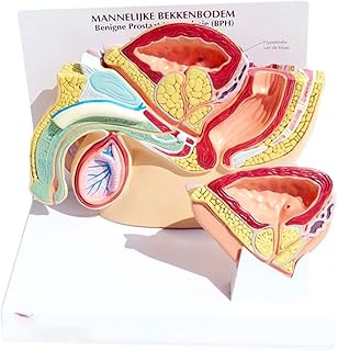 Male Bladder Prostate Normal Hyperplasia Prostate Examination Removable Prostate Model Human Pathology Bladder with Prostate Teaching Demonstration Tool for Medical Education