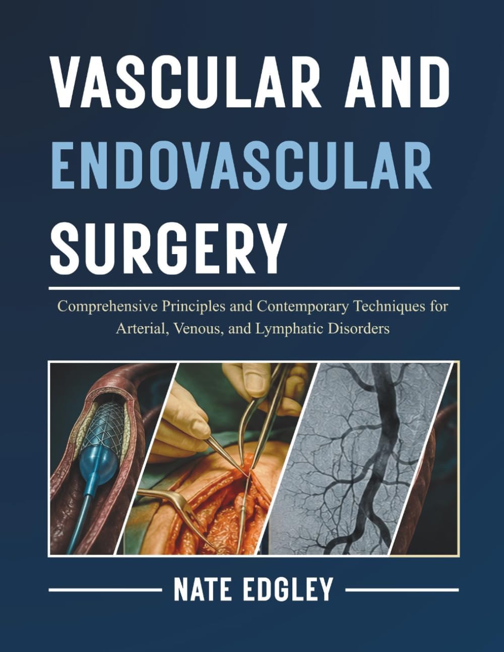 VASCULAR AND ENDOVASCULAR SURGERY: Comprehensive Principles and Contemporary Techniques for Arterial, Venous, and Lymphatic Disorders