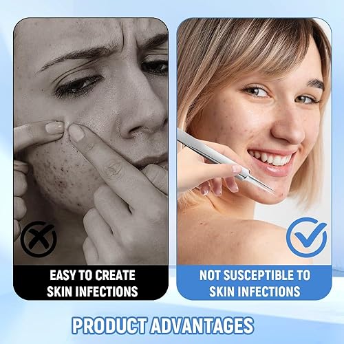 Miniatura 3 de Kit de extracción de herramientas de eliminación de puntos negros de acero inoxidable de grado médico, removedor profesional de puntos negros,