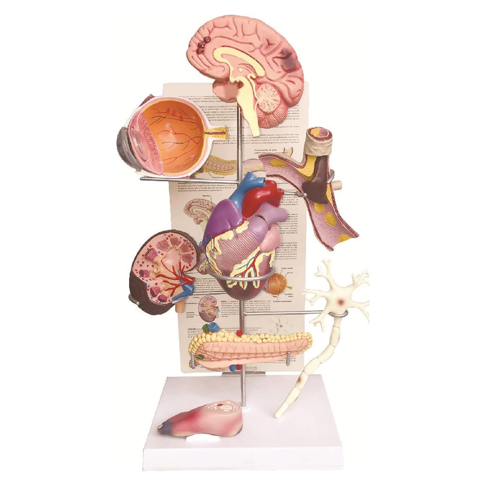 Modèle médical de diabète Modèle Anatomique de diabète Organe Humain Amovible Complications anatomiques du diabète Modèle d'affichage pour la médecine