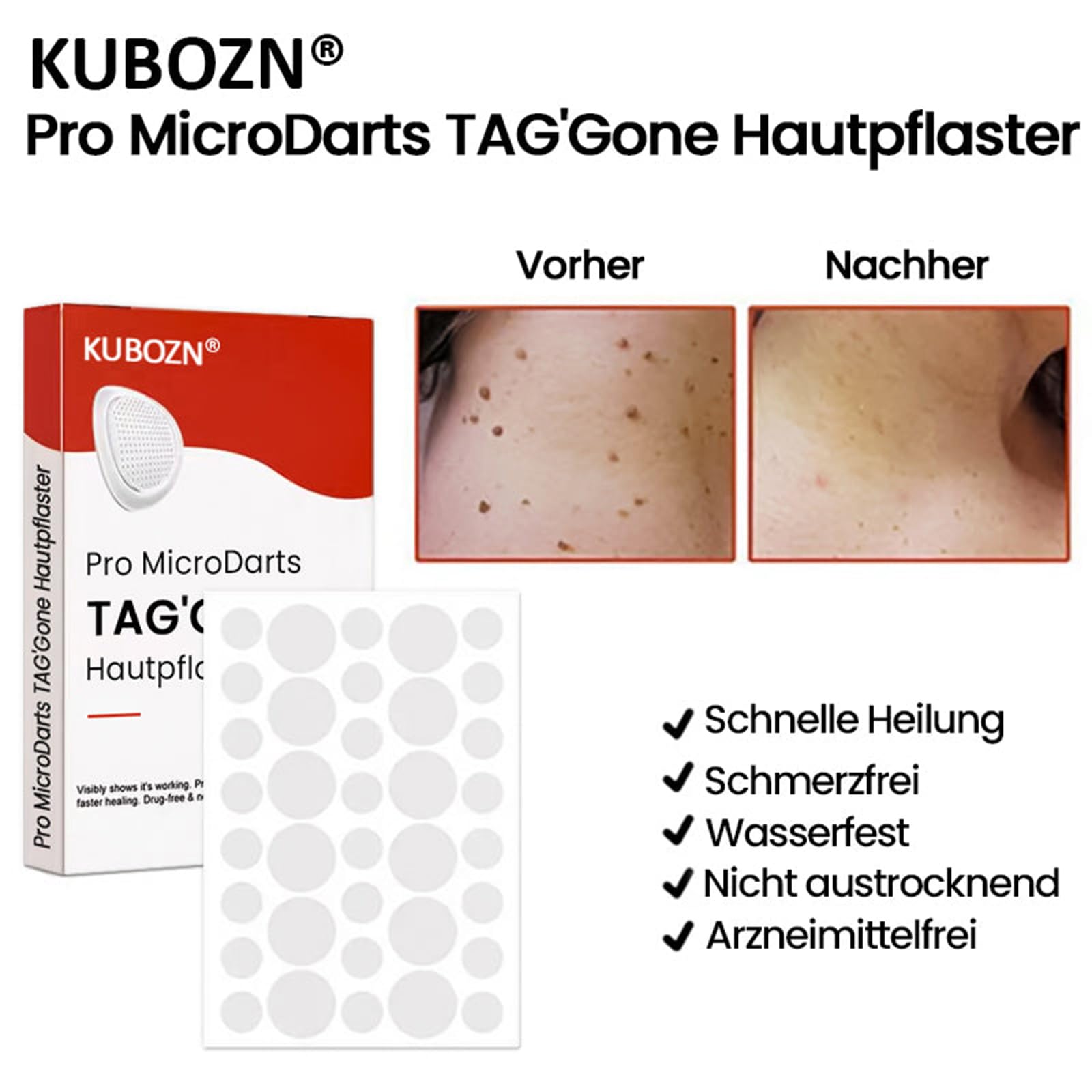 Kubozn Tag Gone Hautpflaster, Kubozn Pro Microdarts Tag Gone Hautpflaster, Micro Pickelpflaster, Natürlich Nano-Pickel Pflaster, Anti-Akne-Pflaster Zum Abdecken Von Pickeln Und Hautun (2)