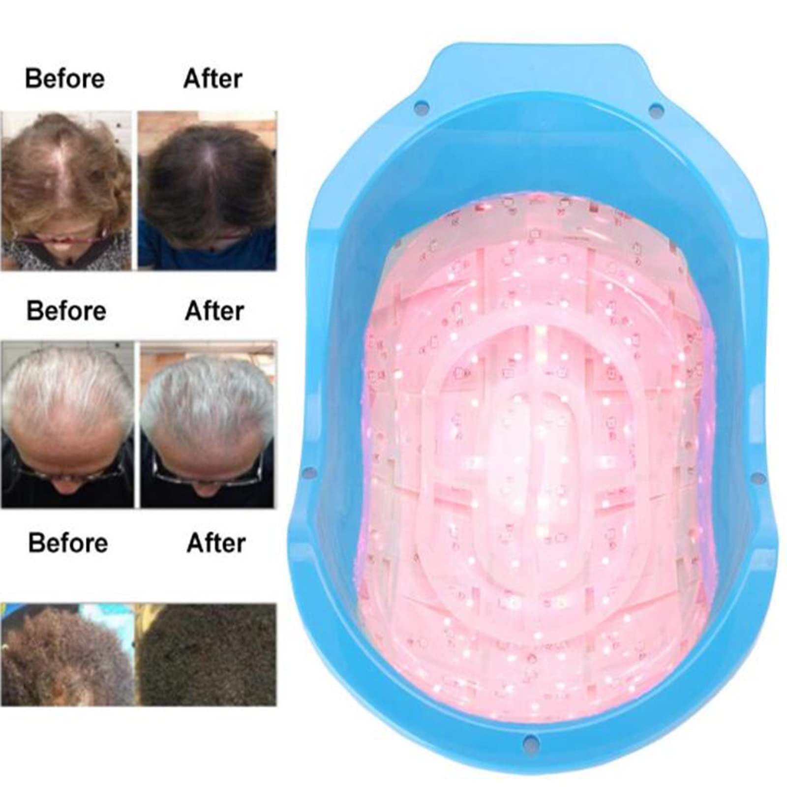 Crescita dei Capelli Laser,Trattamento per La Crescita dei Capelli Diradamento dei Capelli,Strumento per Casco per La Crescita dei Capelli Protettore per La Crescita dei Capelli
