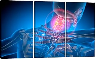 Medical Wall Decor 3 Panel Man with Strong Pain in Neck Print on Canvas Artwork for Home Office Hospital Wall Decorations, Wooden Framed Gallery-Wrapped Ready to Hang, 20x40inchx3
