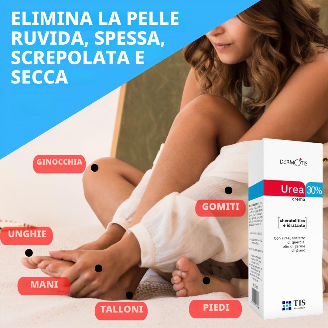 TIS - Crema con urea 30%, per rimozione cicatrici e ferite, eczemi, cheratosi, psoriasi, eruzioni cutanee. Con acido lattico - Alfaidrossiacidi, corteccia di quercia e olio di germe di grano.