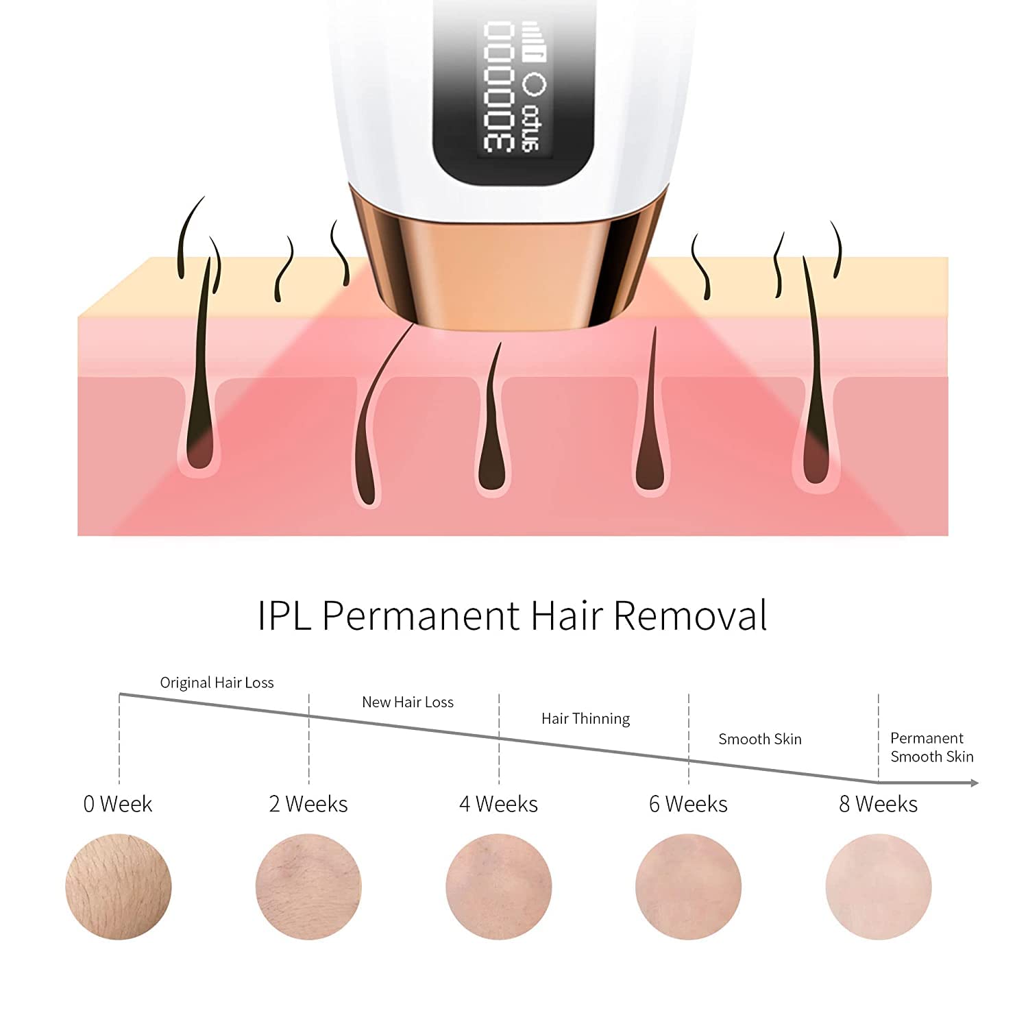 Buy COSBEAUTY IPL Hair Removal for Women and Men, AtHome Permanent Laser Hair Removal Device