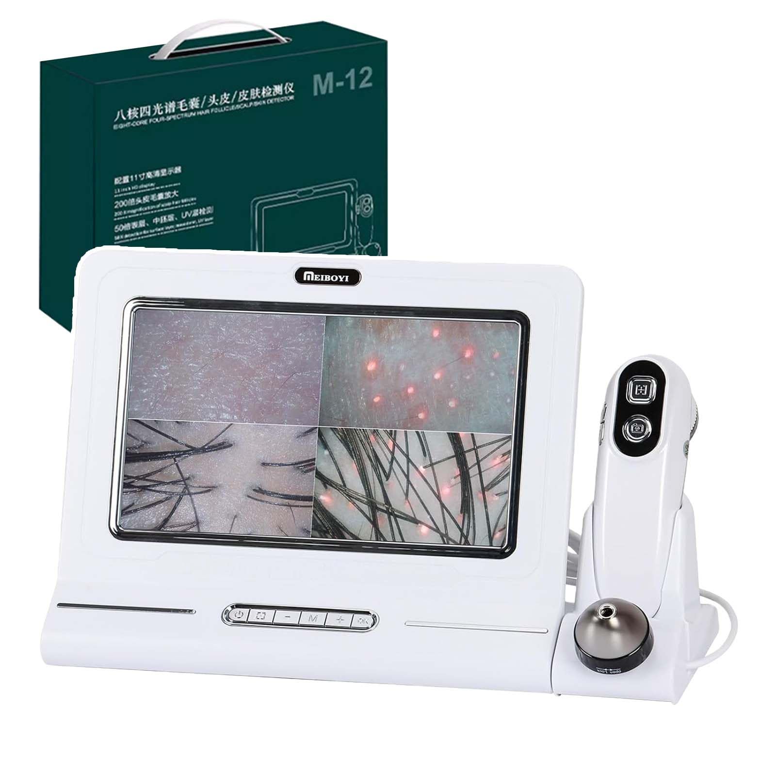 Beoynot Multicolor 11" Hd Display Digital Scalp Microscope & Skin Analyzer Machine, No App Required, With 50X & 200X Pair Handle Probe, For Hair Follicle Analysis In Salons, Clinics, And Home Use