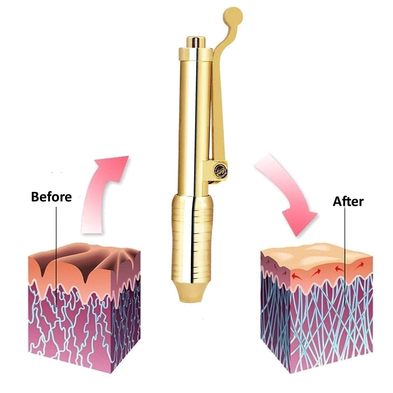 Hyaluronic Acid Pen Kit Hyaluron Micro Iniettore con 5 Testa Fiale Ago Gratuito Iniezione Penna per Sollevamento Pelle Labbra