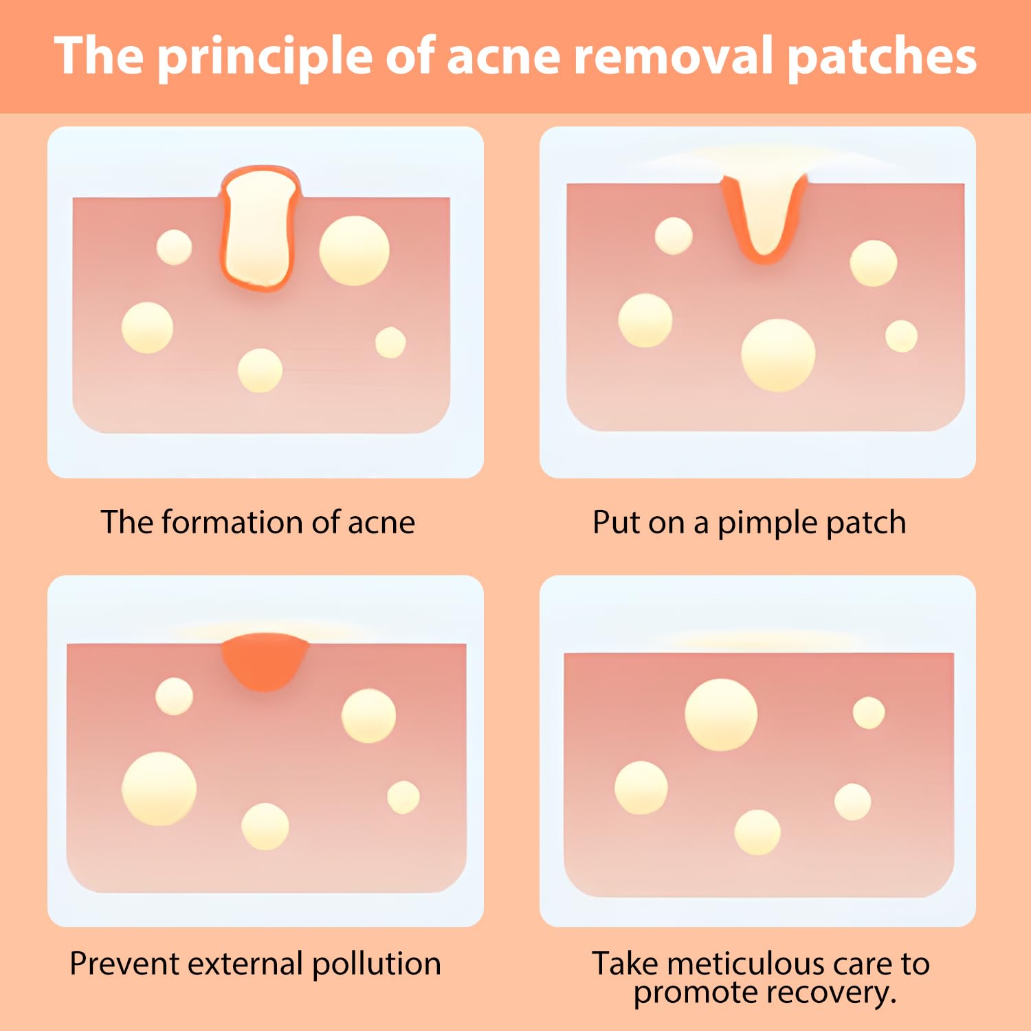 200 Pcs Hydrocolloid Pimple Patches, 5 Colors Star Spot Patches for Face Waterproof Cute Acne Patches for Women and Teens - Image 4