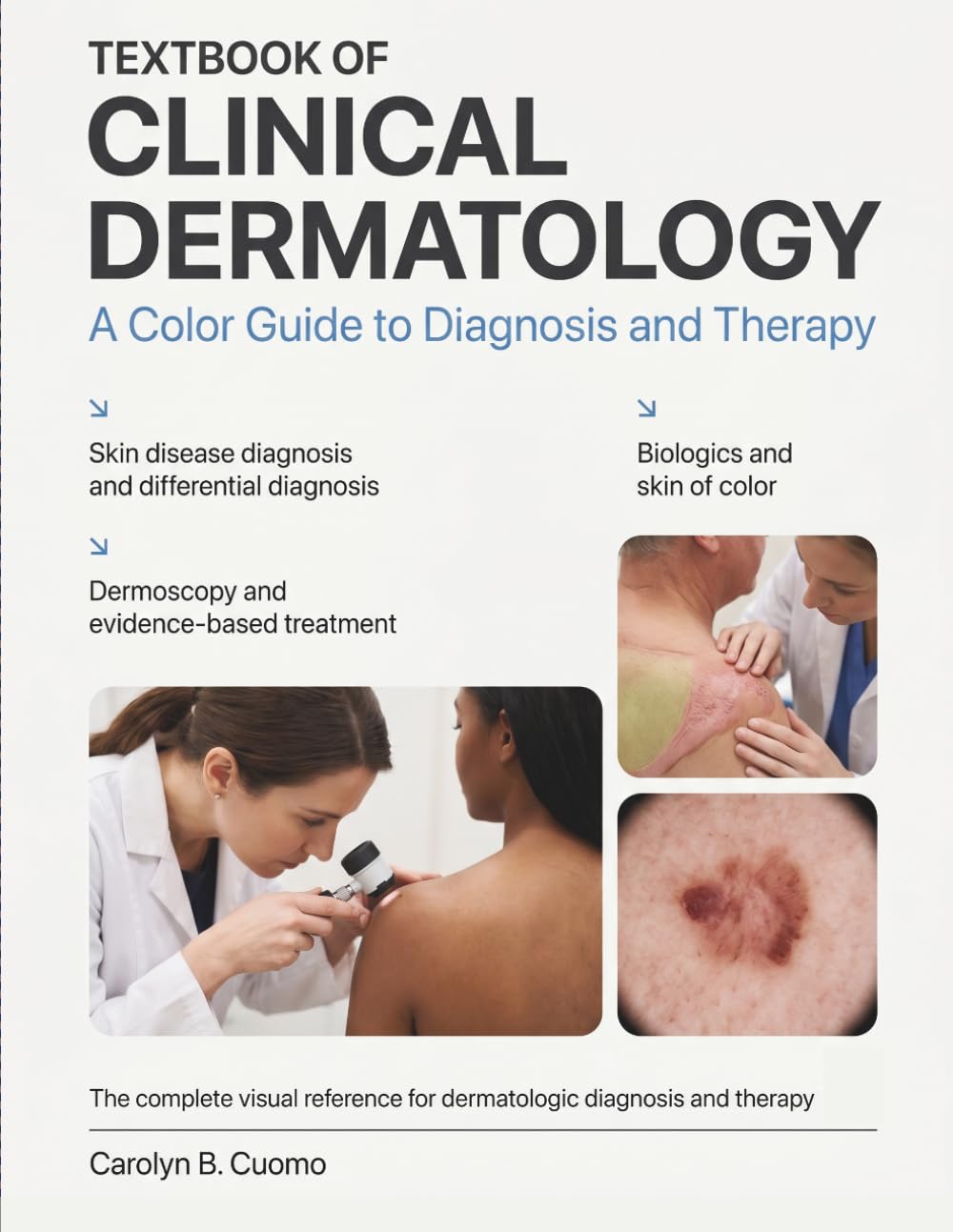 TEXTBOOK OF CLINICAL DERMATOLOGY: The Complete Visual Reference for Skin Disease Diagnosis, Differential Diagnosis, and Evidence-Based Treatment With Dermoscopy, Biologics, and Skin of Color