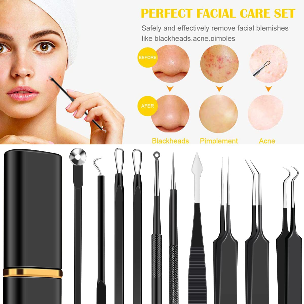 10pcs Pickel-Popper Tool Kit Edelstahl Mitesser Entferner Werkzeug Komedonen Extraktor für Stirn Gesichtsnase Leichtes Akne-Nadelwerkzeug mit Metallkoffer für Reisen Zuhause