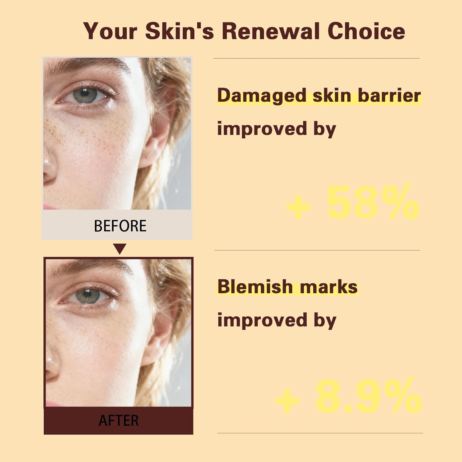 bigyuan PDRN Salmon DNA Cream for Skin Barrier Support and Improved Firmness, 20g / 0.7 oz - Image 6