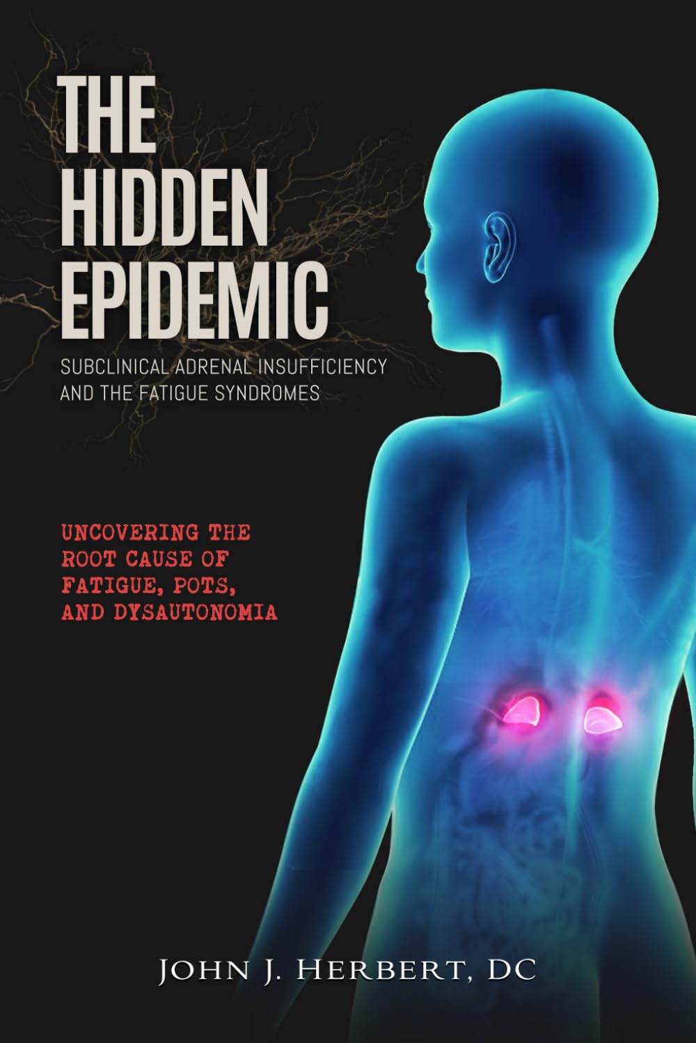 THE HIDDEN EPIDEMIC: Subclinical Adrenal Insufficiency And The Fatigue Syndromes