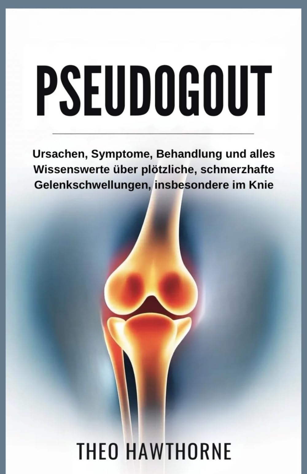 Pseudogout: Ursachen, Symptome, Behandlung und alles Wissenswerte über plötzliche, schmerzhafte Gelenkschwellungen, insbesondere im Knie