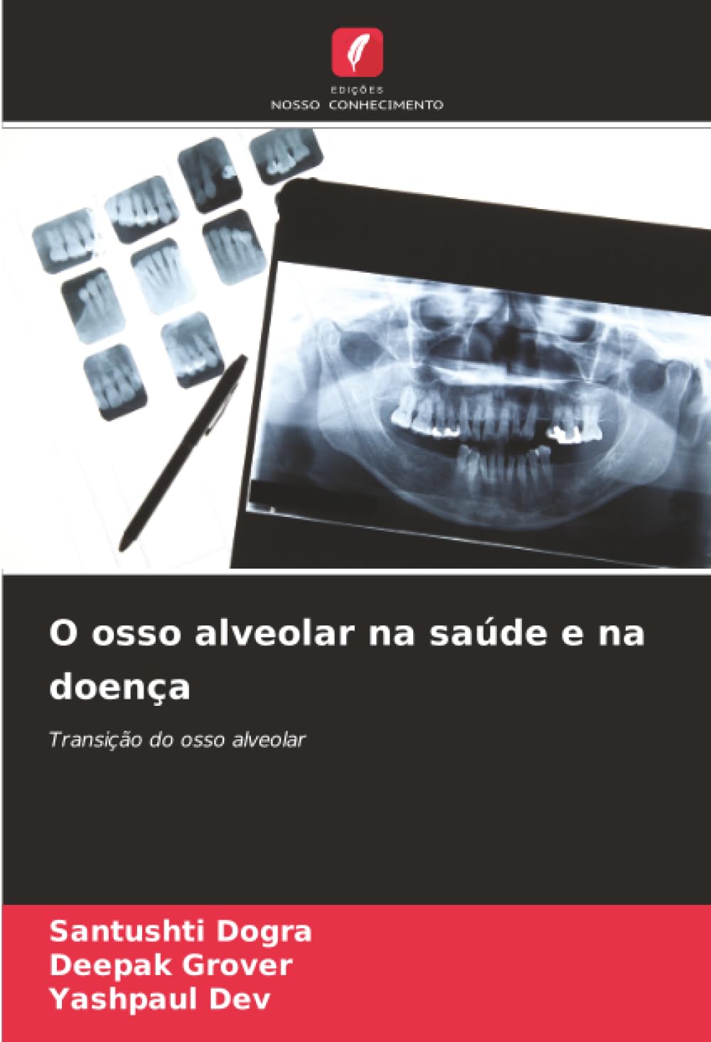 O osso alveolar na saúde e na doença: Transição do osso alveolar