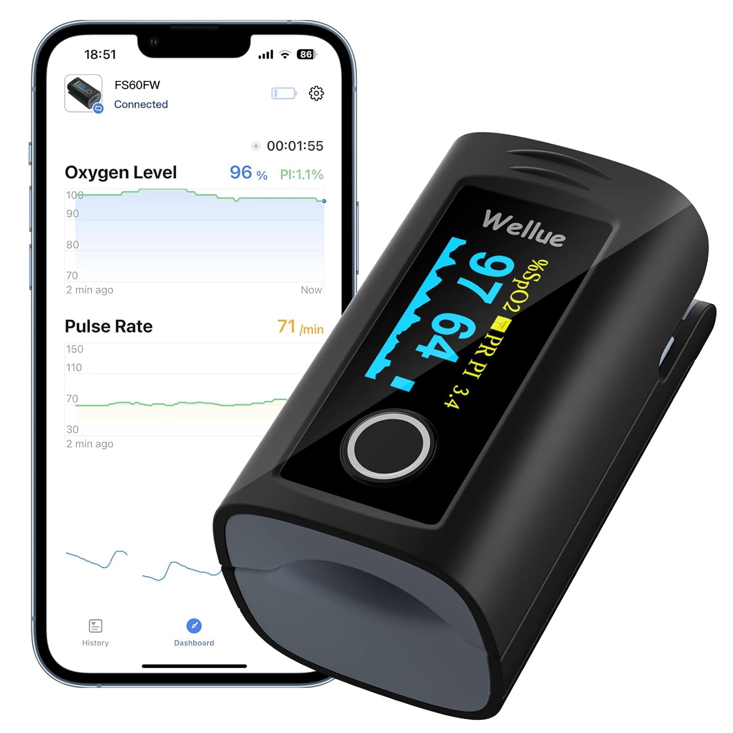 ViATOM Bluetooth Pulse Oximeter Approved UK Builtin Offline Storage