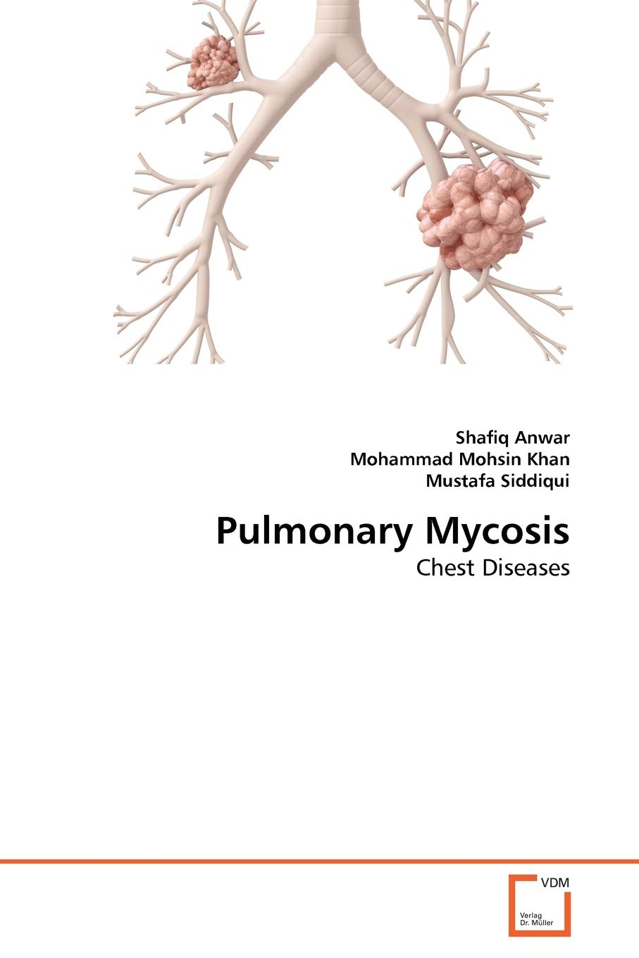 Pulmonary Mycosis: Chest Diseases