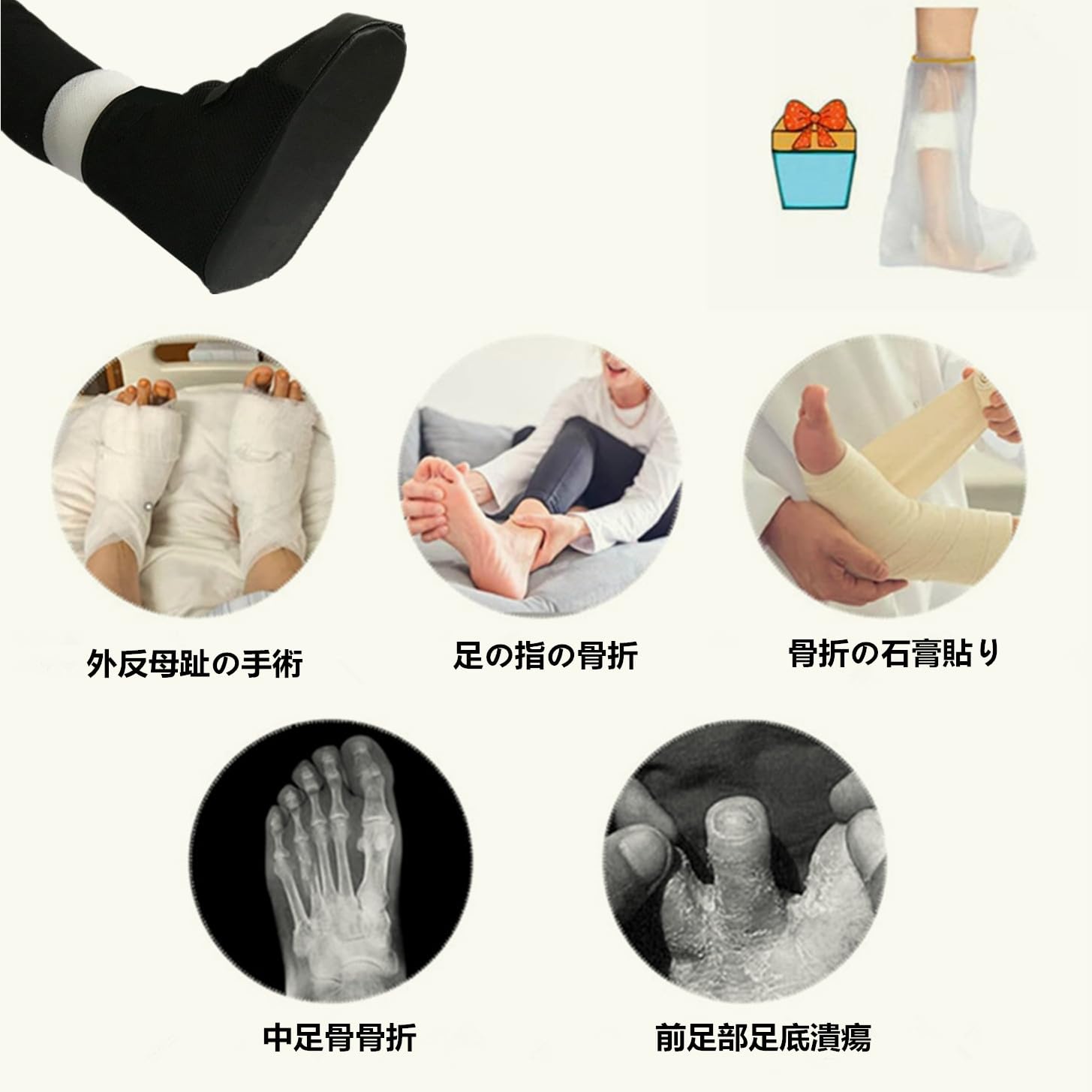 外反母趾手術後リハビリ用の装具