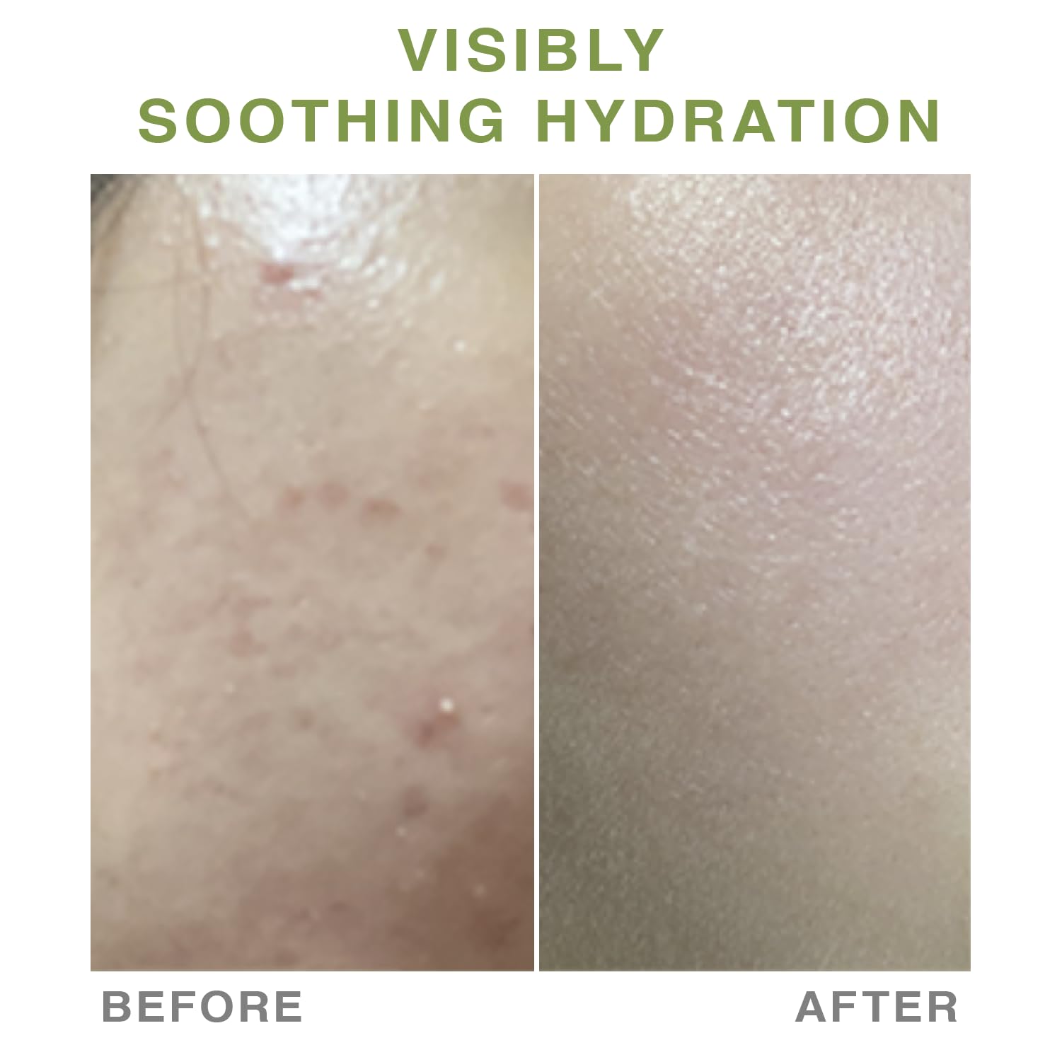 LOAR WATER PORE MASK Deep Collagen Mask Facial Hydrogel Masks with low molecular weight collagen -elasticity, firming, and moisturizing