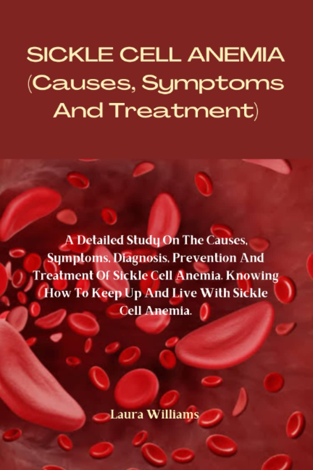SICKLE CELL ANEMIA (Causes, Symptoms And Treatment): A Detailed Study On The Causes, Symptoms, Diagnosis, Prevention And Treatment Of Sickle Cell