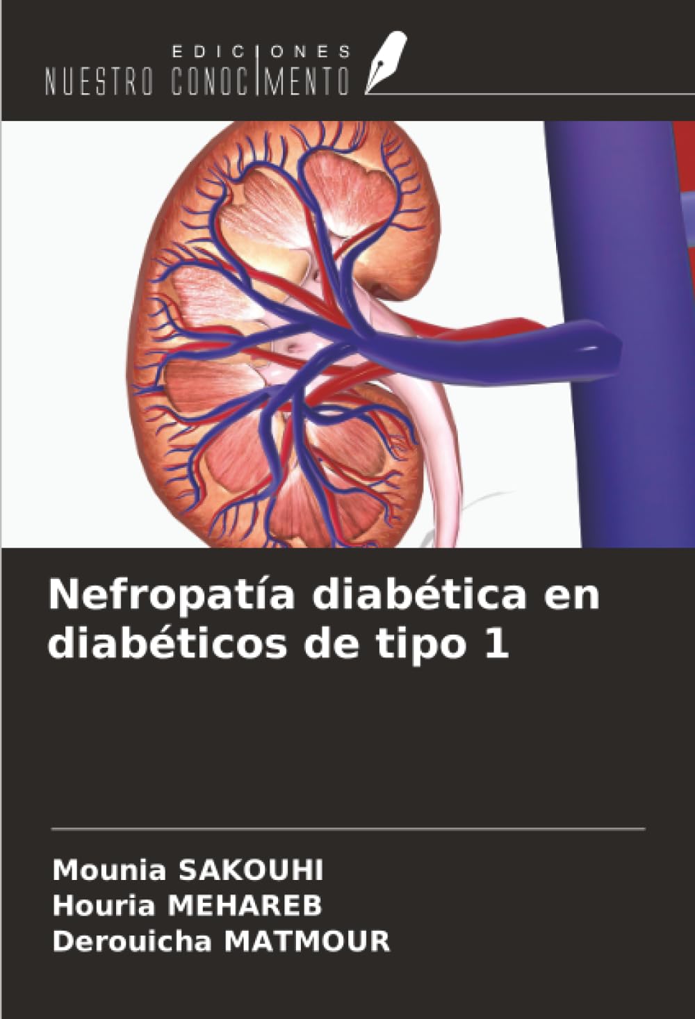 Nefropatía diabética en diabéticos de tipo 1