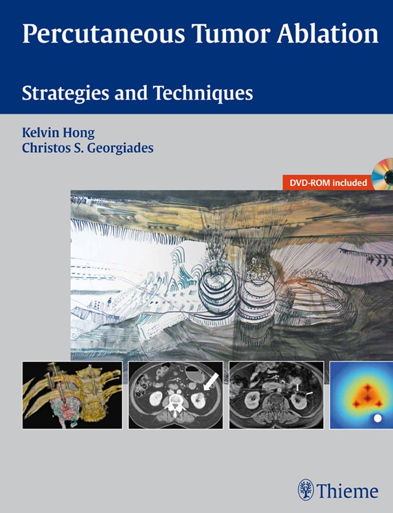 Buy Percutaneous Tumor Ablation: Strategies and Techniques — BookShops.in